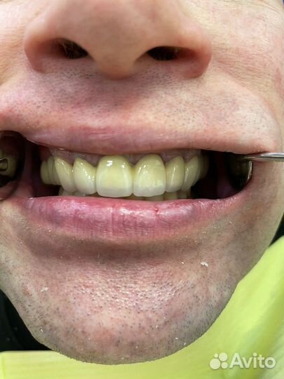 Зубной техник керамист