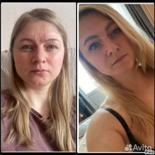 Массаж лица