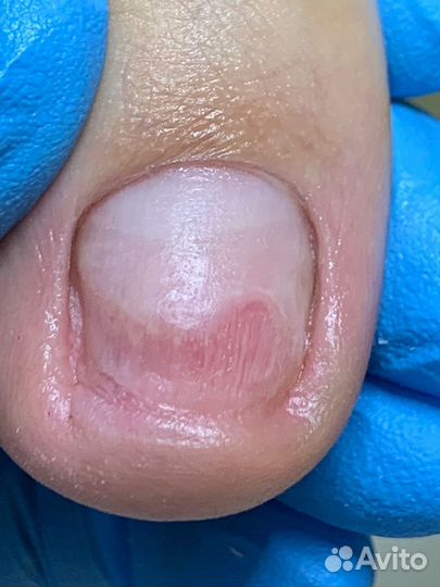 Услуги подолога / выезд на дом