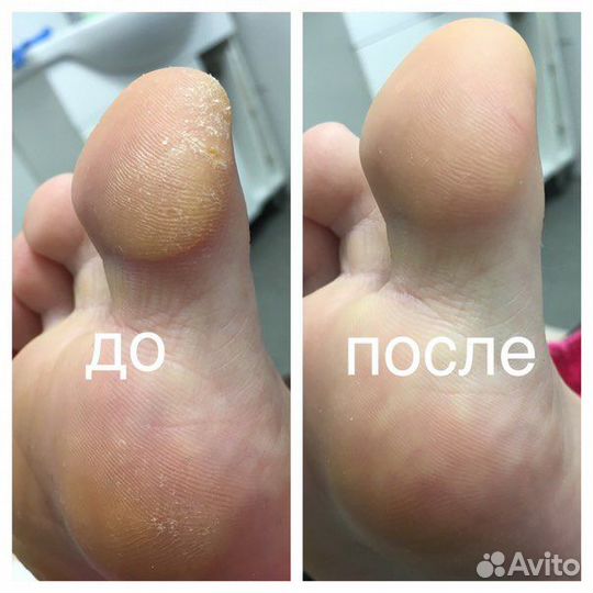 Smart педикюр