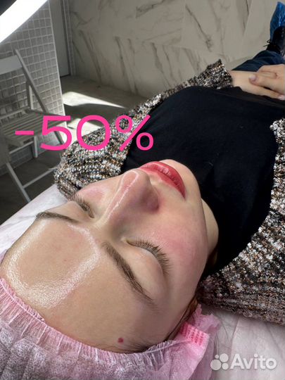 Фотоомоложение лечение постакне сосудов lumecca