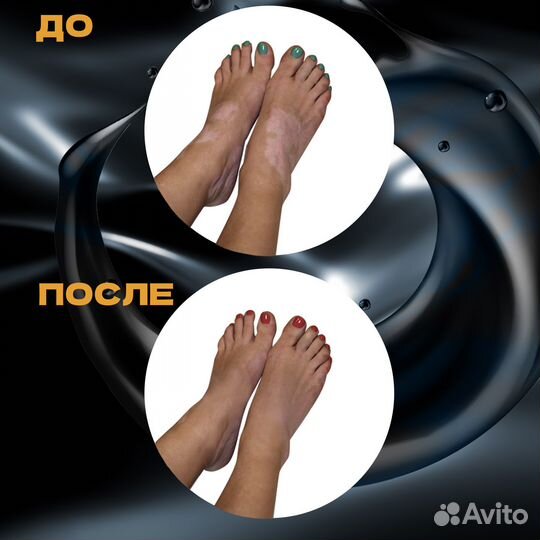 Нафталановый крем Азерфарм от псориаза, дерматита