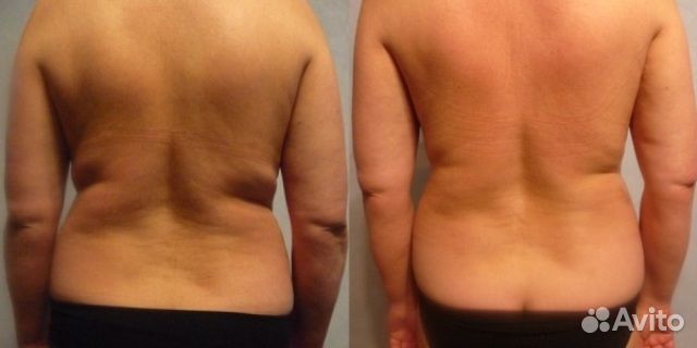 Профессиональный массажист