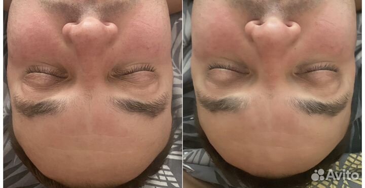 Массаж лица Парковый