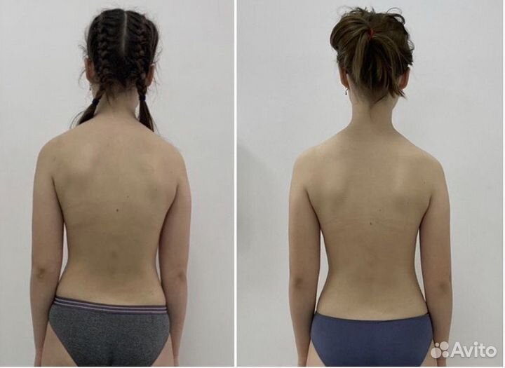 Детский массаж