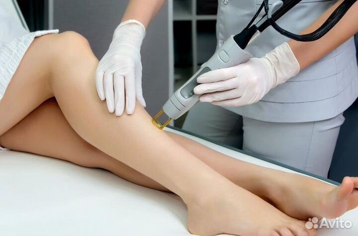 Бизнес под ключ: лазерная эпиляция