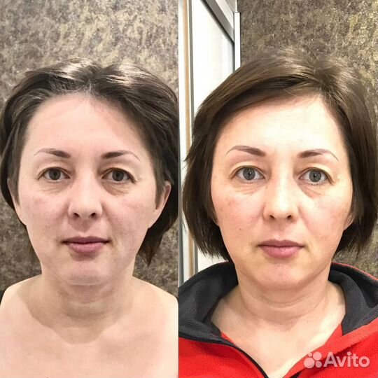 Массаж лица