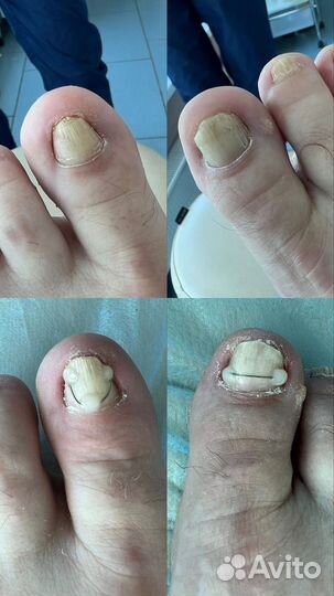 Смарт педикюр