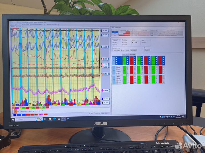 Проверка на полиграфе. Детектор лжи