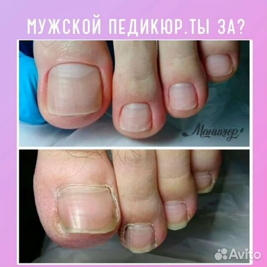 Смарт педикюр