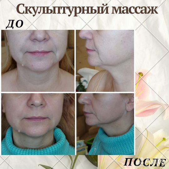 Массаж, аппаратная косметология