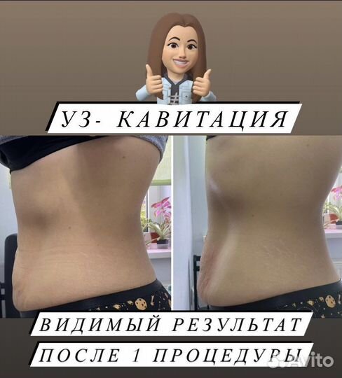 Аппаратная коррекция фигуры