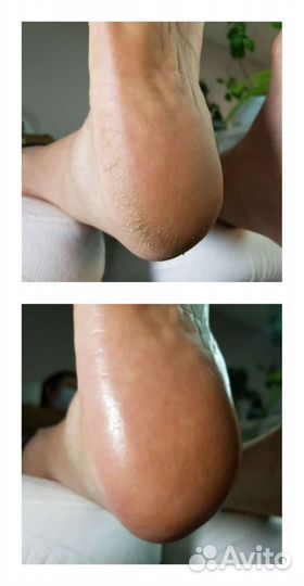 Смарт педикюр