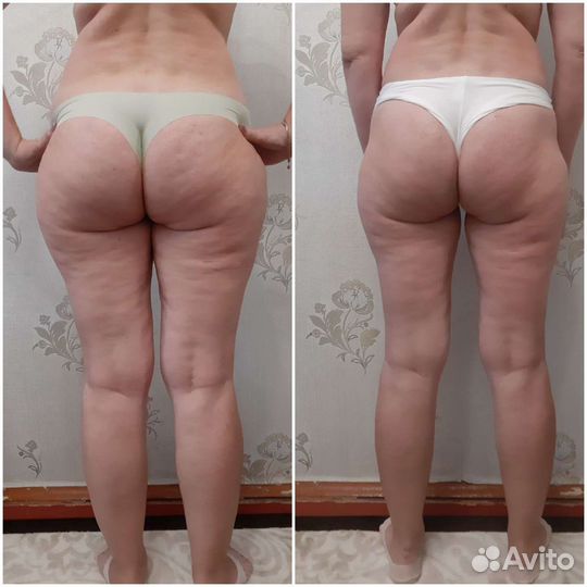 Массаж тела