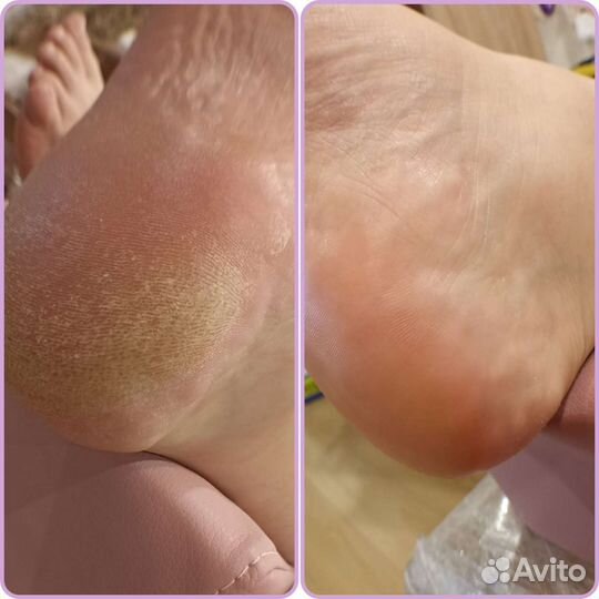 Маникюр & Педикюр