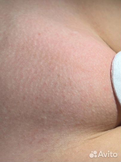 Депиляция Шугаринг