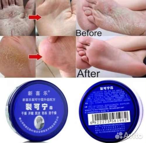 Заживляющий крем, 85 гр