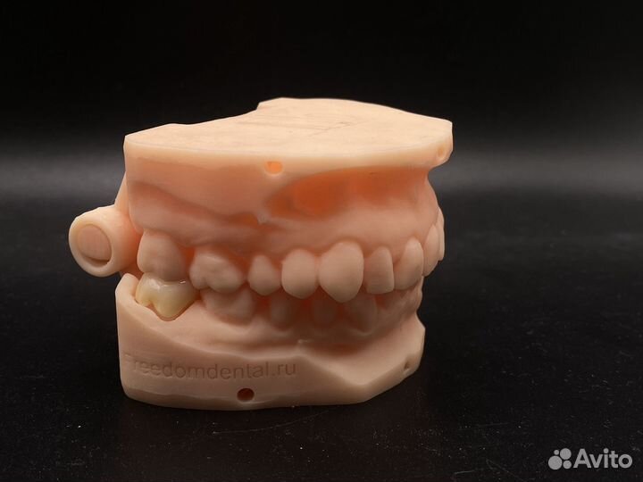 Коронка циркониевая/ e-max наготово по интраоральн