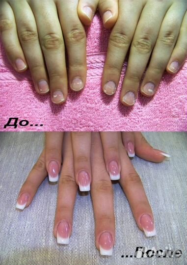 Наращивание ногтей