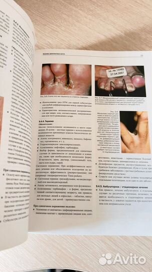 Подология шольц