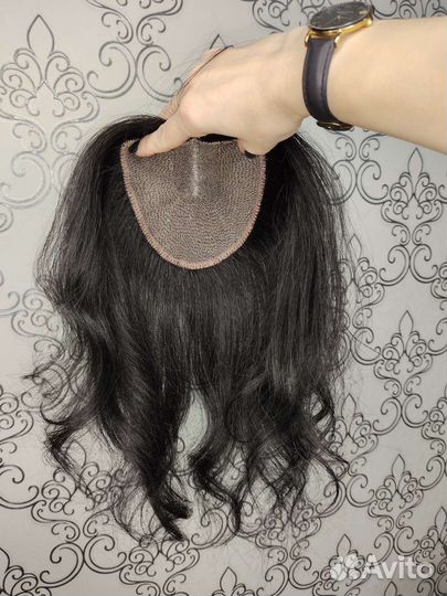 Теменная накладка