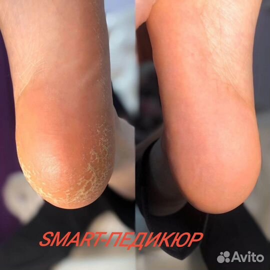 Маникюр, наращивание, smart- педикюр для м/ж