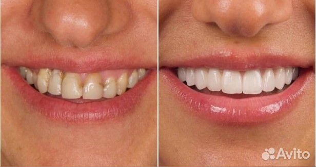 Зуботехническая лаборатория