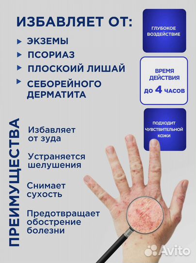 Крем Король кожи от псориаза, прыщей 5 штук