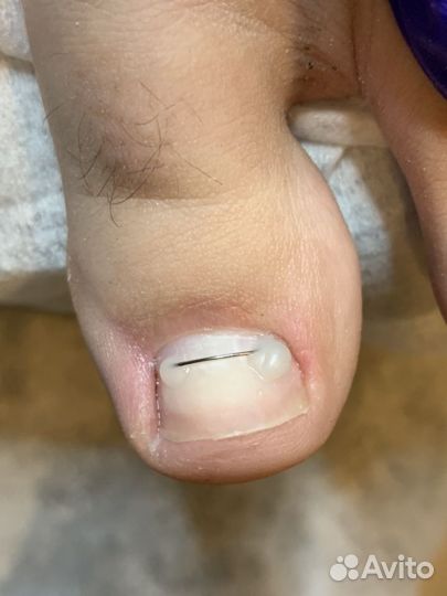 Маникюр, Педикюр, подолог