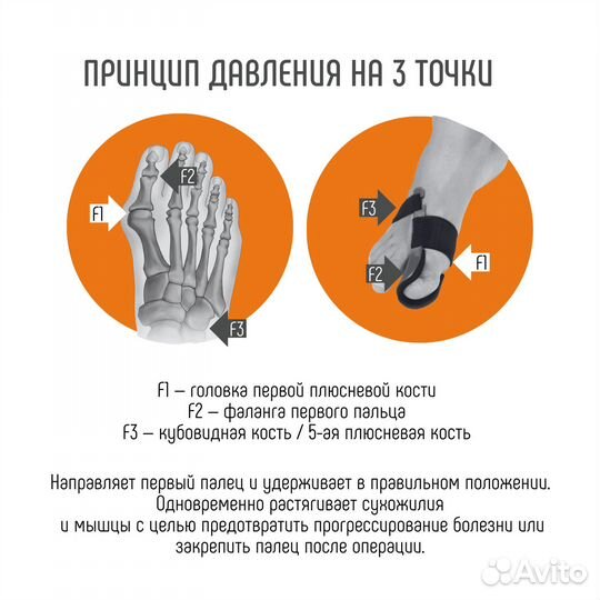 Приспособление при Hallux-Valgus orliman HV-33