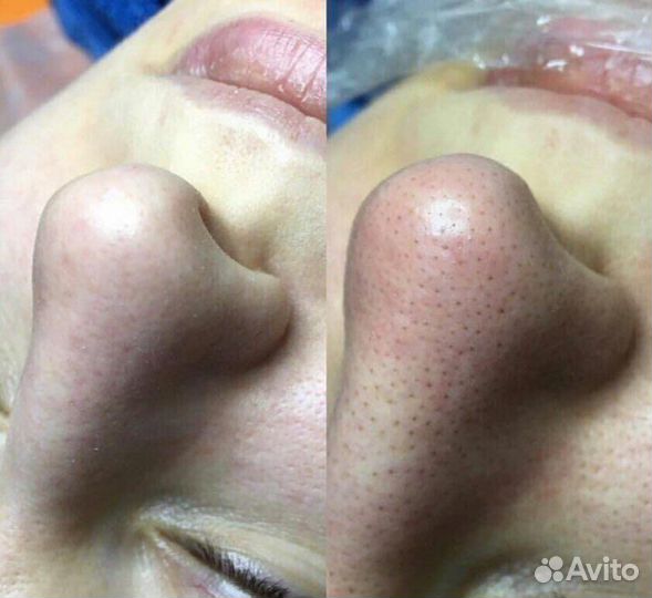 Уходовая косметика