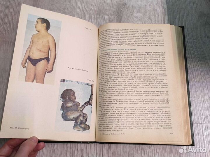 Пропедевтика детских болезней