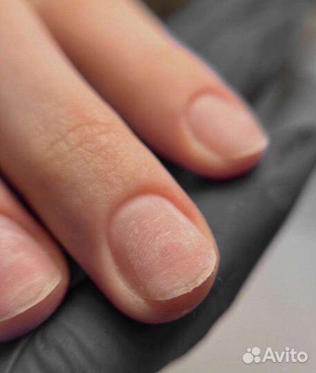 Аппаратный педикюр