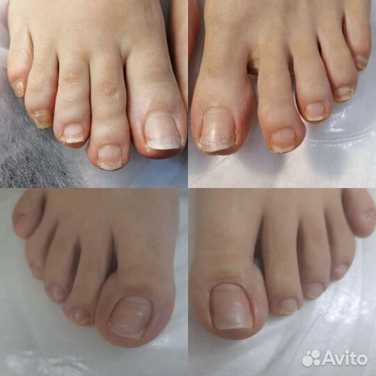 Аппаратный маникюр