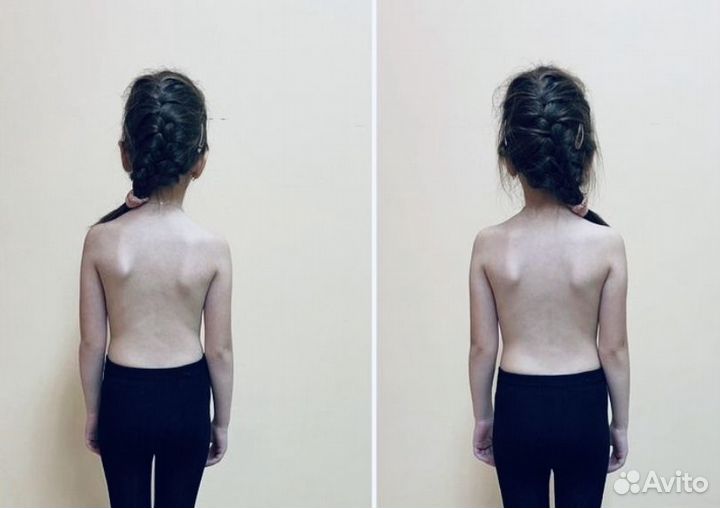 Детский массаж