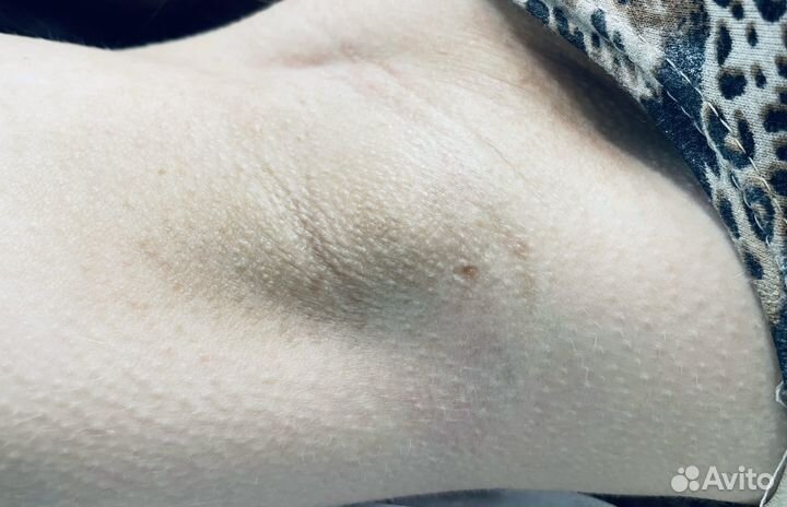 Модель на депиляцию