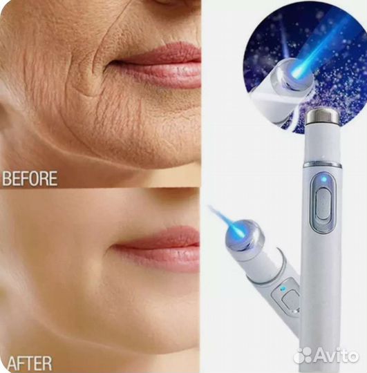 Косметологическая ручка