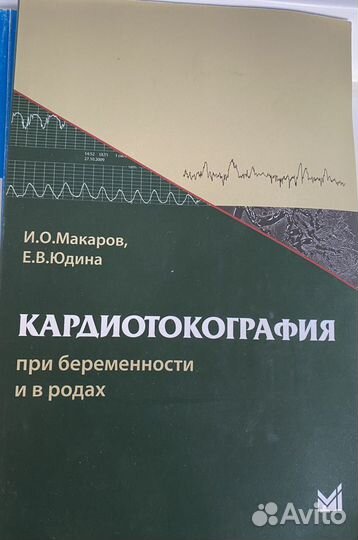 Кардиотокография