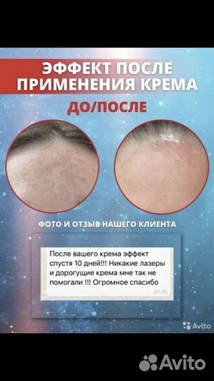 Экспигмент крем против пигментации новый