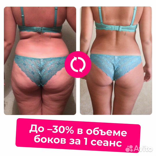 Антицеллюлитный массаж G5 в Москве