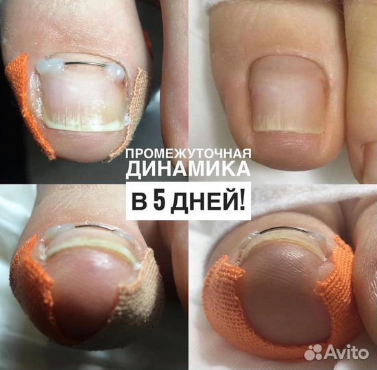 Подолог Маникюр Педикюр