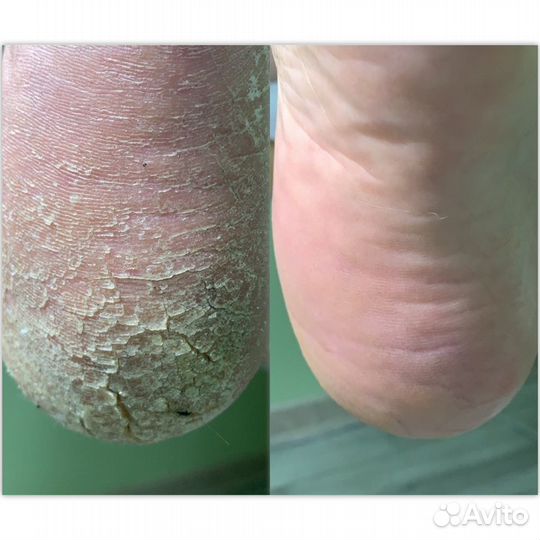 Подолог/медицинский педикюр