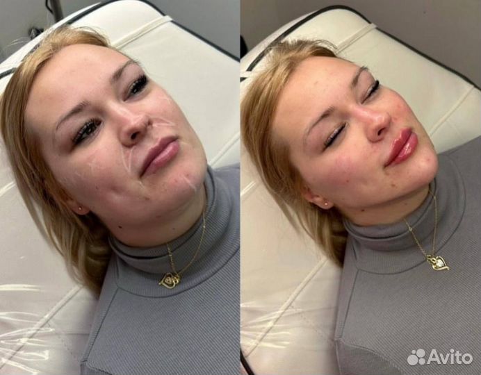 Профиль Джоли