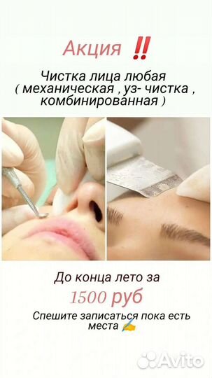 Чистка лица