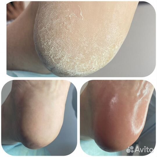 Курсы по педикюру