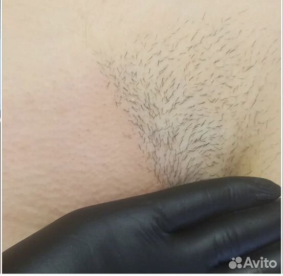 Мастер шугаринга