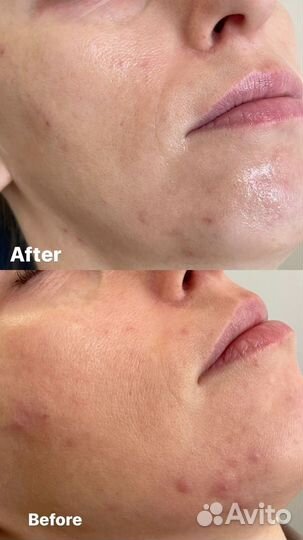 Услуги косметолога