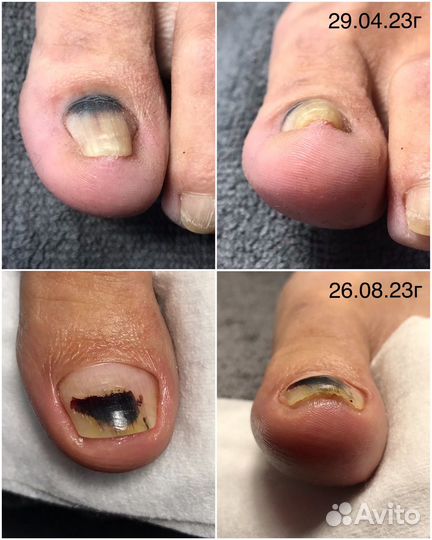 Подология маникюр педикюр