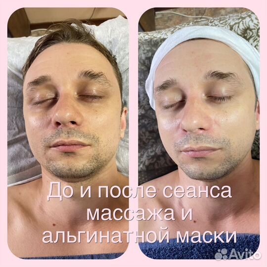 Массаж лица