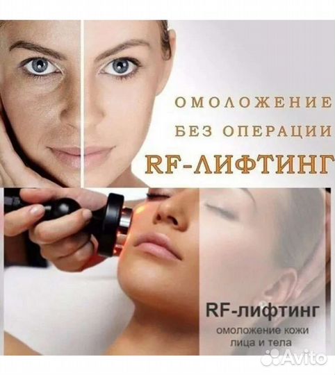 Криолиполиз